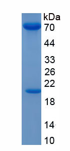 Eukaryotic Proprotein Convertase Subtilisin/Kexin Type 9 (PCSK9)