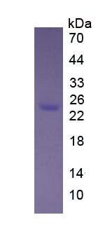 Eukaryotic FK506 Binding Protein 7 (FKBP7)