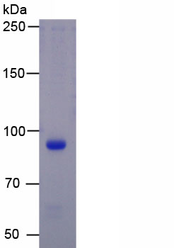 Eukaryotic Glutamate Receptor, Ionotropic, N-Methyl-D-Aspartate 1 (GRIN1)