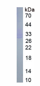 Eukaryotic DNA Methyltransferase 3B (DNMT3B)