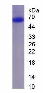Eukaryotic Cytoplasmic Linker Associated Protein 2 (CLASP2)