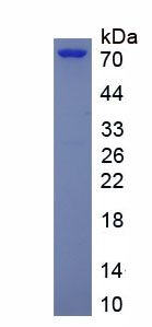 Eukaryotic Leucine Rich Repeat Containing Protein 15 (LRRC15)