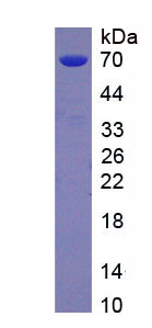 Eukaryotic Leucine Rich Repeat Containing Protein 15 (LRRC15)