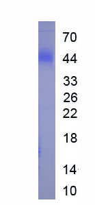 Eukaryotic Nucleoprotein (NP)