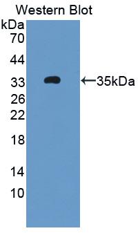 Monoclonal Antibody to Connective Tissue Growth Factor (CTGF)