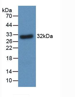 Monoclonal Antibody to Brain Derived Neurotrophic Factor (BDNF)