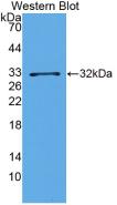 Monoclonal Antibody to Brain Derived Neurotrophic Factor (BDNF)