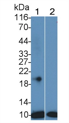 Monoclonal Antibody to S100 Calcium Binding Protein (S100)