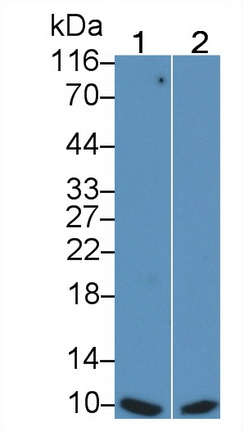 Monoclonal Antibody to S100 Calcium Binding Protein (S100)