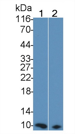 Monoclonal Antibody to S100 Calcium Binding Protein (S100)