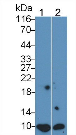 Monoclonal Antibody to S100 Calcium Binding Protein (S100)