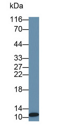 Monoclonal Antibody to S100 Calcium Binding Protein (S100)