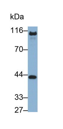 Monoclonal Antibody to E-cadherin