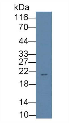 Monoclonal Antibody to Erythropoietin (EPO)