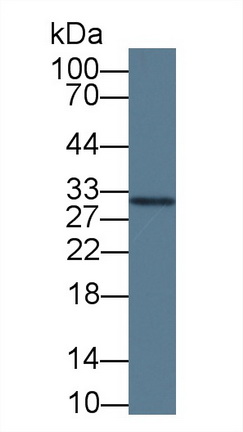 Monoclonal Antibody to Erythropoietin (EPO)