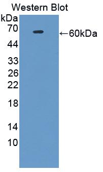 Monoclonal Antibody to Factor Related Apoptosis (FAS)