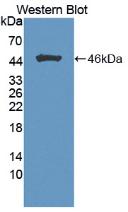 Monoclonal Antibody to Fibroblast Growth Factor 1, Acidic (FGF1)