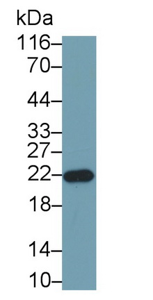 Monoclonal Antibody to Growth Hormone (GH)