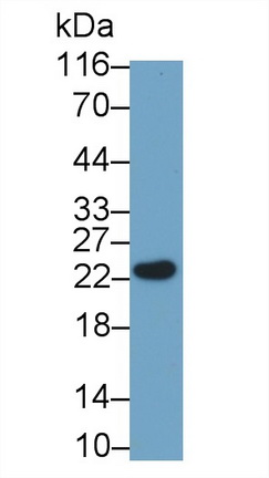 Monoclonal Antibody to Growth Hormone (GH)