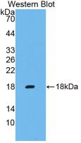 Monoclonal Antibody to Interferon Gamma (IFNg)