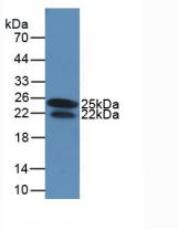 Monoclonal Antibody to Interferon Gamma (IFNg)