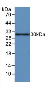 Monoclonal Antibody to Insulin Like Growth Factor Binding Protein 1 (IGFBP1)