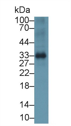 Monoclonal Antibody to Insulin Like Growth Factor Binding Protein 1 (IGFBP1)