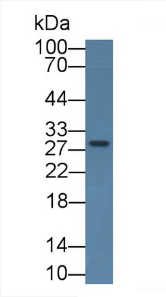 Monoclonal Antibody to Insulin Like Growth Factor Binding Protein 1 (IGFBP1)