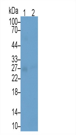 Monoclonal Antibody to Insulin Like Growth Factor Binding Protein 1 (IGFBP1)