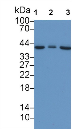 Monoclonal Antibody to Insulin Like Growth Factor Binding Protein 3 (IGFBP3)