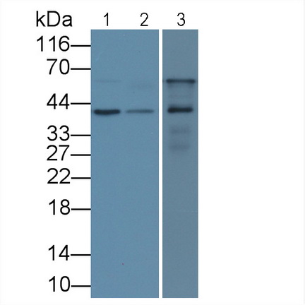 Monoclonal Antibody to Insulin Like Growth Factor Binding Protein 3 (IGFBP3)