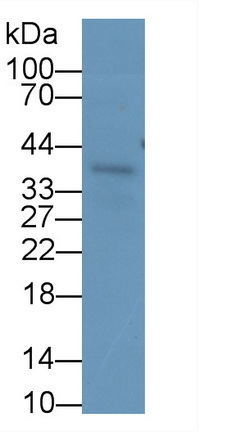 Monoclonal Antibody to Insulin Like Growth Factor Binding Protein 3 (IGFBP3)