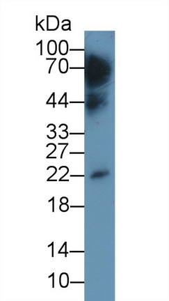 Monoclonal Antibody to Interleukin 10 (IL10)