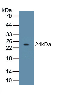 Monoclonal Antibody to Interleukin 10 (IL10)