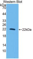 Monoclonal Antibody to Interleukin 10 (IL10)