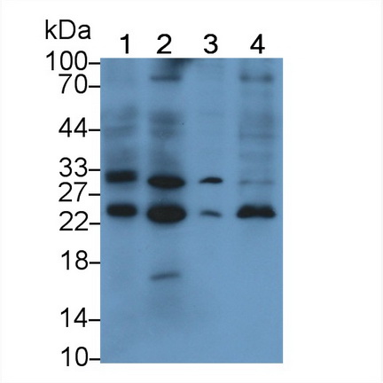 Monoclonal Antibody to Interleukin 10 (IL10)