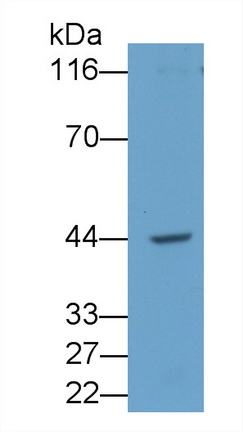 Monoclonal Antibody to Interleukin 12B (IL12B)