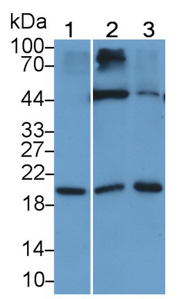 Monoclonal Antibody to Interleukin 15 (IL15)