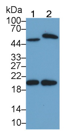 Monoclonal Antibody to Interleukin 15 (IL15)