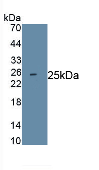 Monoclonal Antibody to Interleukin 18 (IL18)