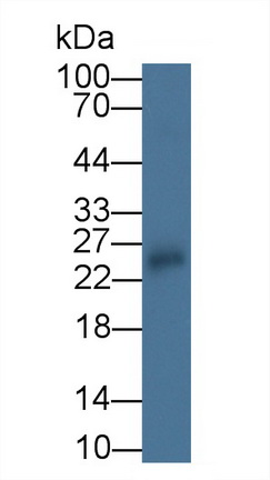 Monoclonal Antibody to Interleukin 18 (IL18)