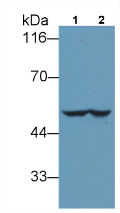 Monoclonal Antibody to Glial Fibrillary Acidic Protein (GFAP)