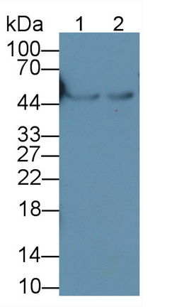 Monoclonal Antibody to Glial Fibrillary Acidic Protein (GFAP)