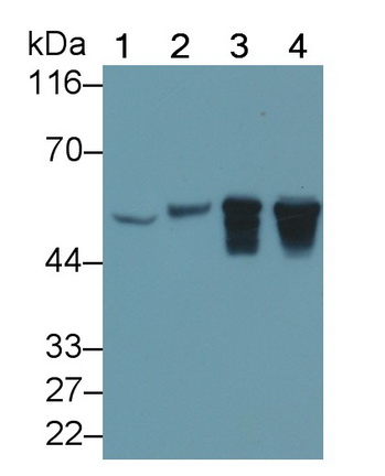 Monoclonal Antibody to Glial Fibrillary Acidic Protein (GFAP)