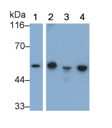 Monoclonal Antibody to Glial Fibrillary Acidic Protein (GFAP)