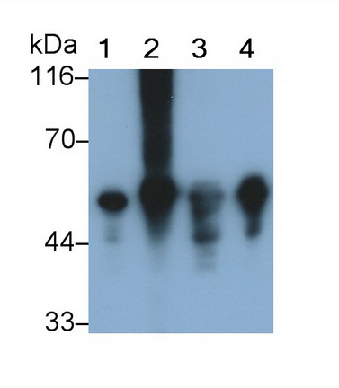 Monoclonal Antibody to Glial Fibrillary Acidic Protein (GFAP)