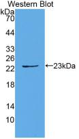 Monoclonal Antibody to Interleukin 1 Alpha (IL1a)