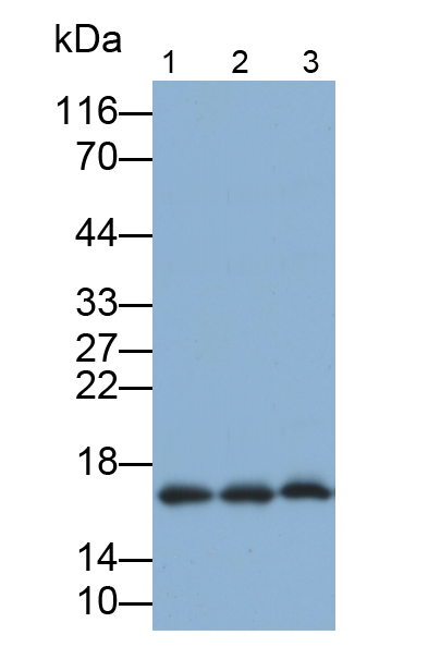 Monoclonal Antibody to Interleukin 5 (IL5)