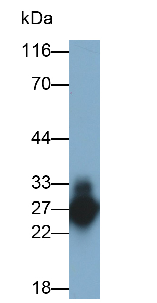 Monoclonal Antibody to Interleukin 6 (IL6)
