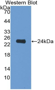 Monoclonal Antibody to Interleukin 6 (IL6)